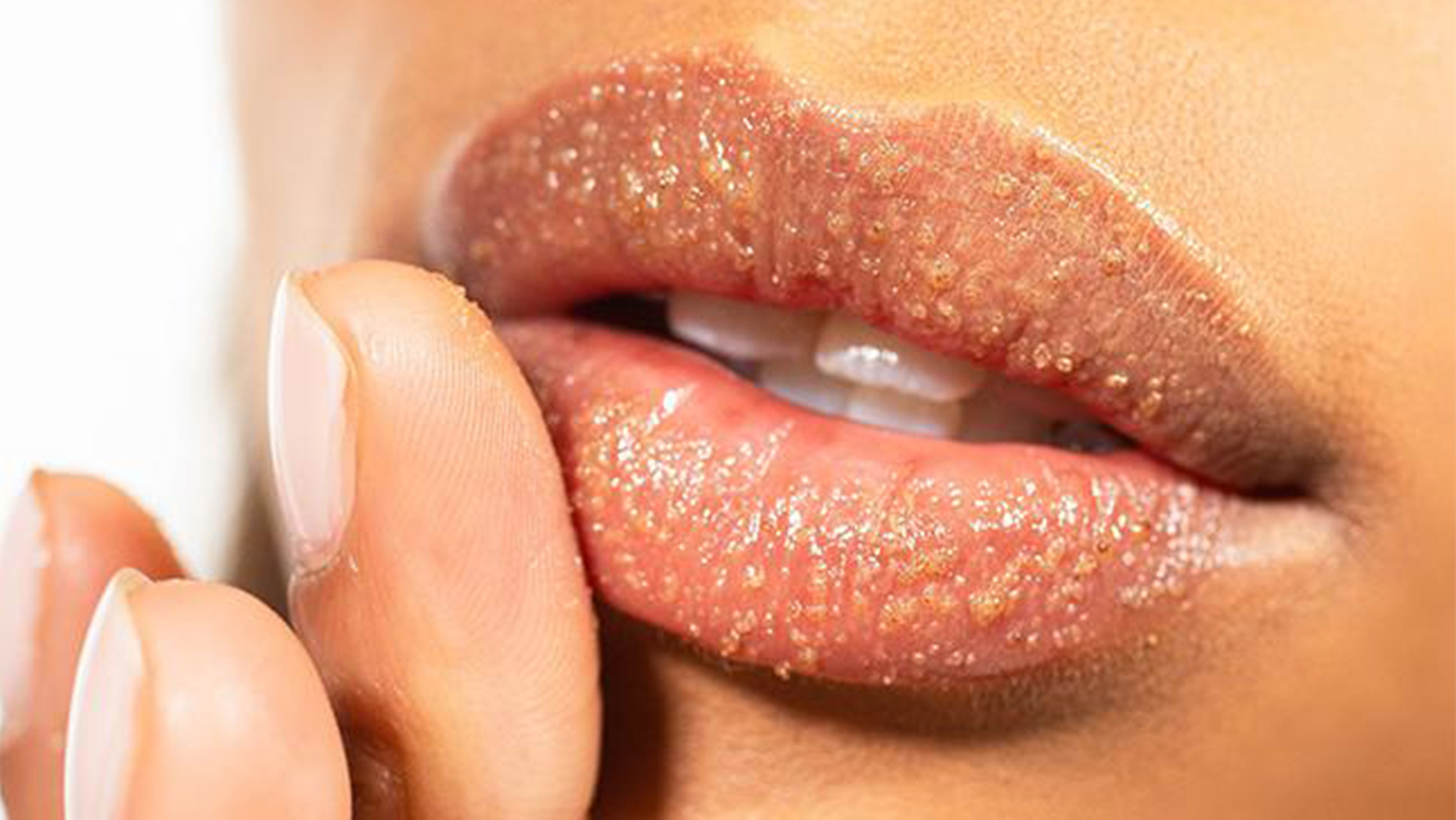 5 Cara Mengatasi Bibir Kering dan Pecah-Pecah Saat Puasa